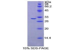 SDS-PAGE analysis of Rat Ribonuclease Inhibitor Protein. (RNH1 Protéine)