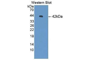 Detection of Recombinant SYT1, Human using Polyclonal Antibody to Synaptotagmin I (SYT1)