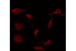 ABIN6276058 staining Hela by IF/ICC. (TACR1 anticorps  (Internal Region))