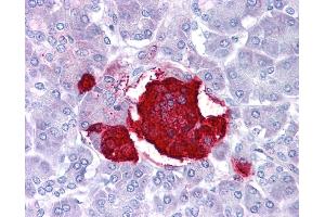 Leptin antibody was used for immunohistochemistry at a concentration of 4-8 ug/ml. (Leptin anticorps  (Middle Region))