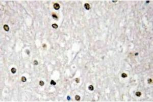 Immunohistochemistry (IHC) analyzes of p73 antibody in paraffin-embedded human brain tissue. (Tumor Protein p73 anticorps)