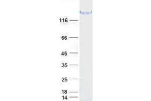 Validation with Western Blot