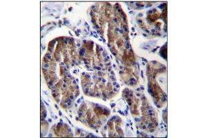 Immunohistochemistry analysis in Formalin Fixed, Paraffin Embedded Human stomach tissue using RPS4Y1 Antibody (Center) followed by peroxidase conjugation of the secondary antibody and DAB staining.