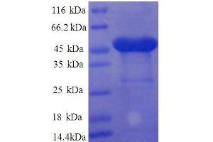 Ribosomal Protein L11 (RPL11) (AA 3-178), (partial) protein (GST tag) (RPL11 Protein (AA 3-178, partial) (GST tag))