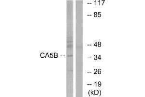 Western Blotting (WB) image for anti-Carbonic Anhydrase VB, Mitochondrial (CA5B) (C-Term) antibody (ABIN1851011) (CA5B anticorps  (C-Term))