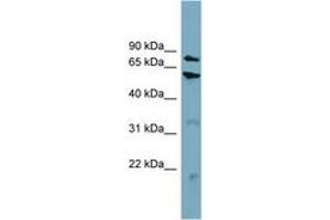 Image no. 1 for anti-Carnitine Palmitoyltransferase 1B (Muscle) (CPT1B) (AA 359-408) antibody (ABIN6743419) (CPT1B anticorps  (AA 359-408))