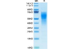 Mouse IL-18BP on Tris-Bis PAGE under reduced condition. (IL18BP Protein (AA 29-193) (His tag))