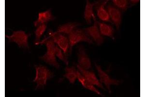 anti-Protein-tyrosine Phosphatase 1C (PTPN6) (C-Term) antibody