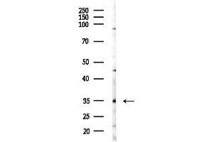 Western blot analysis of lysates from MDA-MB-231 cells(heat-shock,45 min treatment), using OR11 Antibody at 1/1000 dilution.
