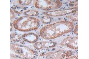 Used in DAB staining on fromalin fixed paraffin- embedded Kidney tissue (KTN1 anticorps  (AA 1104-1357))