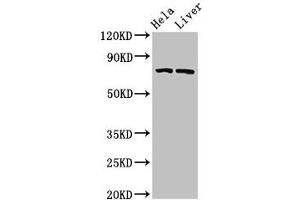 Western Blot Positive WB detected in: Hela whole cell lysate, Rat liver tissue All lanes: ACSL5 antibody at 3 μg/mL Secondary Goat polyclonal to rabbit IgG at 1/50000 dilution Predicted band size: 76, 83, 74, kDa Observed band size: 76 kDa (ACSL5 anticorps  (AA 33-683))