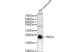 Western blot analysis of extracts of Rat stomach, using REG4 antibody (ABIN6132619, ABIN6146859, ABIN6146860 and ABIN6217007) at 1:1000 dilution. (REG4 anticorps  (AA 23-158))