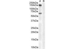 Western Blotting (WB) image for anti-Monoamine Oxidase B (MAOB) (Internal Region) antibody (ABIN2465923) (Monoamine Oxidase B anticorps  (Internal Region))