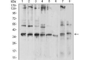 Western blot analysis using CD137 mouse mAb against HepG2 (1), Jurkat (2), MOLT4 (3), HL-60 (4), THP-1 (5), Ramos (6), K562 (7), and Raji (8) cell lysate.