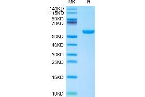 Mouse CD27 Ligand/CD70 on Tris-Bis PAGE under reduced condition.
