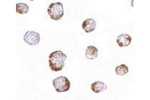 Immunocytochemistry of HINT1 in Jurkat cells with AP30394PU-N HINT1 antibody at 2.