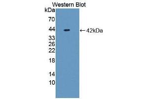 Western blot analysis of recombinant Rat NFkB. (NFkB anticorps  (AA 352-439))