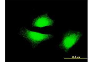 Immunofluorescence of monoclonal antibody to MAP2K5 on HeLa cell. (MAP2K5 anticorps  (AA 1-120))