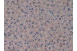 DAB staining on IHC-P; Samples: Mouse Liver Tissue (FIL1d anticorps  (AA 1-156))