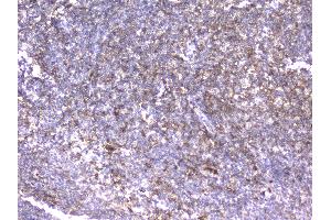 IHC analysis of ITGB2 using anti-ITGB2 antibody .