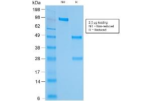 SDS-PAGE Analysis of Purified HSP60 Recombinant Mouse Monoclonal Antibody ABIN6383811.