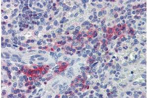 Immunohistochemistry staining of human spleen (paraffin sections) with anti-LIME polyclonal antibody.