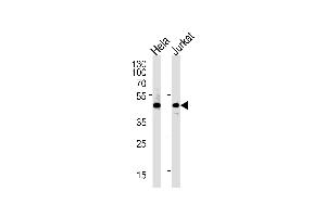 Western blot analysis of lysates from Hela,Jurkat cell line (from left to right),using PTGDR Antibody (ABIN486691 and ABIN1536072). (PTGDR anticorps)