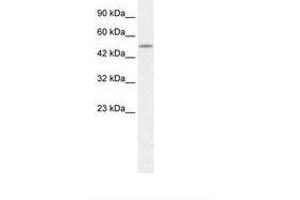 Image no. 1 for anti-CAMP Responsive Element Binding Protein 3-Like 2 (CREB3L2) (AA 34-72) antibody (ABIN202707) (CREB3L2 anticorps  (AA 34-72))
