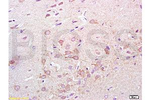 Formalin-fixed and paraffin embedded rat lung tissue labeled with Anti-Synaptotagmin 1/SYT1 Polyclonal Antibody, Unconjugated (ABIN754888) at 1:200 followed by conjugation to the secondary antibody, (SP-0023), and DAB staining