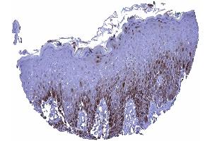 In the skin a nuclear and cytoplasmic Glutamine Synthetase staining can be seen in the lower third and in the top layers of the squamous epithelium