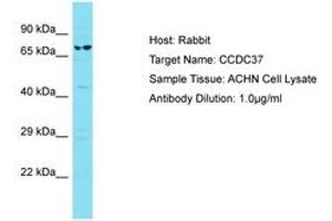Image no. 1 for anti-Coiled-Coil Domain Containing 37 (CCDC37) (AA 528-577) antibody (ABIN6750799) (CCDC37 anticorps  (AA 528-577))