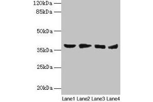 Western blot All lanes: AKR1C2 antibody at 14 μg/mL Lane 1: HepG2 whole cell lysate Lane 2: MCF-7 whole cell lysate Lane 3: Hela whole cell lysate Lane 4: Rat liver tissue Secondary Goat polyclonal to rabbit IgG at 1/10000 dilution Predicted band size: 37, 16 kDa Observed band size: 37 kDa (AKR1C2 anticorps  (AA 1-323))