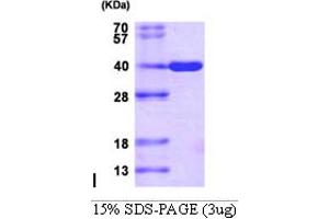 SDS-PAGE (SDS) image for Aldo-Keto Reductase Family 1, Member C3 (3-alpha Hydroxysteroid Dehydrogenase, Type II) (AKR1C3) (AA 1-323) protein (His tag) (ABIN666747)
