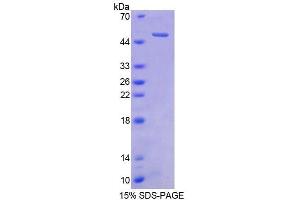 SDS-PAGE analysis of Human CBLN1 Protein.
