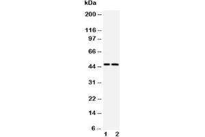 Western blot testing of Caspase-2 antibody and Lane 1:  CEM;  2: SMMC-7721 cell lysate (Caspase 2 anticorps  (AA 417-439))