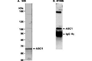 Immunoprecipitation (IP) image for anti-Thyroid Hormone Receptor Interactor 4 (TRIP4) (AA 75-125) antibody (ABIN7449573)
