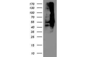 anti-Dihydrolipoamide Dehydrogenase (DLD) antibody