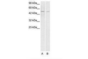 Image no. 1 for anti-ERG, ETS transcription factor (ERG) (AA 228-277) antibody (ABIN203153) (ERG anticorps  (AA 228-277))