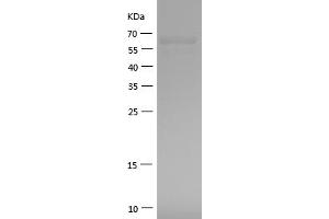 Western Blotting (WB) image for Heat Shock 60kDa Protein 1 (Chaperonin) (HSPD1) (AA 225-573) protein (GST tag) (ABIN7123267)