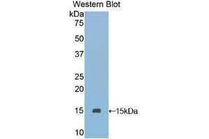 Western blot analysis of the recombinant protein. (SLURP1 anticorps  (AA 1-103))