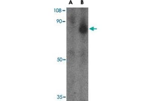 Western blot analysis of FEZ1 in SK-N-SH cell lysate with FEZ1 polyclonal antibody  at 1 ug/mL in the (A) presence and (B) absence of blocking peptide. (FEZ1 anticorps  (C-Term))