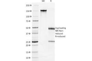 SDS-PAGE Analysis Purified Cytokeratin 7 Mouse Monoclonal Antibody (OV-TL12/30). (Cytokeratin 7 anticorps)