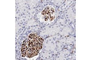 Immunohistochemical staining of human kidney with PRX polyclonal antibody  shows strong cytoplasmic and nuclear positivity in cells in glomeruli at 1:200-1:500 dilution. (Periaxin anticorps)