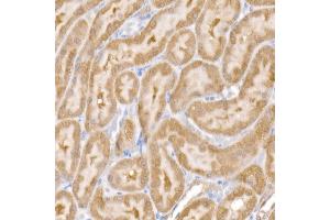 Immunohistochemistry of paraffin-embedded rat kidney using SARA Rabbit mAb (ABIN7271559) at dilution of 1:50 (40x lens). (ZFYVE9 anticorps)