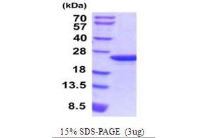 SDS-PAGE (SDS) image for Myosin Regulatory Light Chain 2, Smooth Muscle Isoform (MYL9) (AA 1-172) protein (His tag) (ABIN5854221)