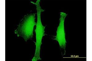 Immunofluorescence of purified MaxPab antibody to AGBL5 on HeLa cell.