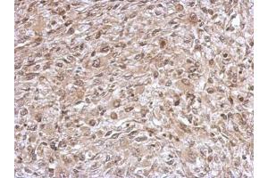 IHC-P Image Immunohistochemical analysis of paraffin-embedded C2C12 xenograft, using TrxR1, antibody at 1:500 dilution. (TXNRD1 anticorps)