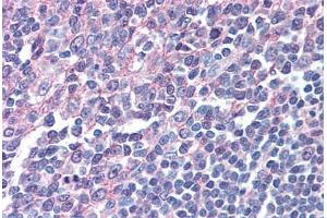Human Tonsil (Formalin-Fixed Paraffin-Embed) stained with IRF8 antibody ABIN305734 at 5 ug/ml followed by biotinylated anti-goat IgG secondary antibody ABIN481715, alkaline phosphatase-streptavidin and chromogen. (IRF8 anticorps  (AA 414-426))