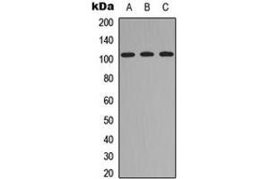 Western blot analysis of ITIH4 70k expression in HEK293T (A), Raw264. (ITIH4 70k (Center) anticorps)