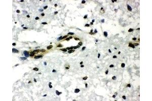 IHC-P: CtBP1 antibody testing of rat brain tissue